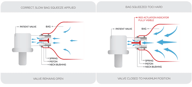 smartbag-diagram-620x280